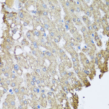 SET / TAF-I Antibody - Immunohistochemistry of paraffin-embedded human liver injury tissue.