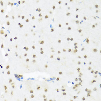 SET / TAF-I Antibody - Immunohistochemistry of paraffin-embedded mouse brain tissue.