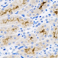 SET / TAF-I Antibody - Immunohistochemical analysis of SET staining in mouse kidney formalin fixed paraffin embedded tissue section. The section was pre-treated using heat mediated antigen retrieval with sodium citrate buffer (pH 6.0). The section was then incubated with the antibody at room temperature and detected using an HRP conjugated compact polymer system. DAB was used as the chromogen. The section was then counterstained with hematoxylin and mounted with DPX.