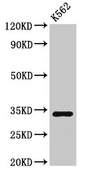 SET / TAF-I Antibody - Positive Western Blot detected in K562 whole cell lysate. All lanes: SET antibody at 3 µg/ml Secondary Goat polyclonal to rabbit IgG at 1/50000 dilution. Predicted band size: 34, 33, 31, 32 KDa. Observed band size: 34 KDa