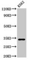 SET / TAF-I Antibody - Positive Western Blot detected in K562 whole cell lysate. All lanes: SET antibody at 3 µg/ml Secondary Goat polyclonal to rabbit IgG at 1/50000 dilution. Predicted band size: 34, 33, 31, 32 KDa. Observed band size: 34 KDa