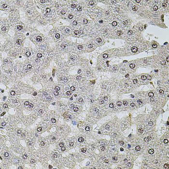 SET / TAF-I Antibody - Immunohistochemistry of paraffin-embedded rat liver using SET antibody at dilution of 1:100 (40x lens).