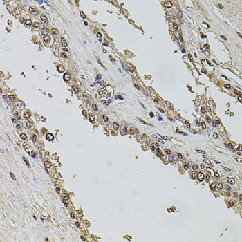 SET / TAF-I Antibody - Immunohistochemistry of paraffin-embedded human prostate using SET antibody at dilution of 1:100 (40x lens).