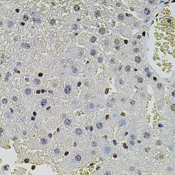 SET / TAF-I Antibody - Immunohistochemistry of paraffin-embedded mouse liver using SET antibody at dilution of 1:100 (40x lens).