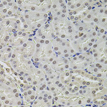 SET / TAF-I Antibody - Immunohistochemistry of paraffin-embedded mouse kidney using SET antibody at dilution of 1:100 (40x lens).