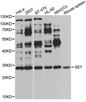 SET / TAF-I Antibody - Western blot analysis of extracts of various cell lines, using SET antibody at 1:1000 dilution. The secondary antibody used was an HRP Goat Anti-Rabbit IgG (H+L) at 1:10000 dilution. Lysates were loaded 25ug per lane and 3% nonfat dry milk in TBST was used for blocking. An ECL Kit was used for detection and the exposure time was 30s.
