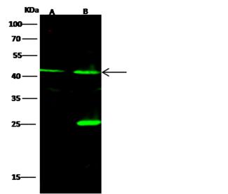 SET / TAF-I Antibody - Anti-SET rabbit polyclonal antibody at 1:500 dilution. Lane A: 293T Whole Cell Lysate. Lane B: HeLa Whole Cell Lysate. Lysates/proteins at 30 ug per lane. Secondary: Goat Anti-Rabbit IgG H&L (Dylight 800) at 1/10000 dilution. Developed using the Odyssey technique. Performed under reducing conditions. Predicted band size: 33 kDa. Observed band size: 42 kDa. (We are unsure as to the identity of these extra bands.)