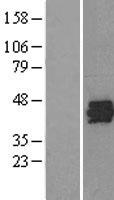 SET / TAF-I Protein - Western validation with an anti-DDK antibody * L: Control HEK293 lysate R: Over-expression lysate