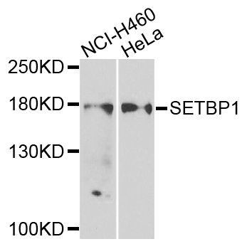 SETBP1 / SEB Antibody - Western blot analysis of extracts of various cells.