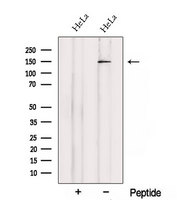 SETBP1 / SEB Antibody - Western blot analysis of extracts of HeLa cells using SETBP1 antibody. The lane on the left was treated with blocking peptide.