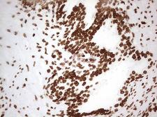 SETD1A / SET1 Antibody - Immunohistochemical staining of paraffin-embedded Human prostate tissue within the normal limits using anti-SETD1A mouse monoclonal antibody. (Heat-induced epitope retrieval by 1 mM EDTA in 10mM Tris, pH8.5, 120C for 3min,