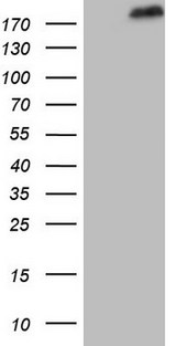 SETD1A / SET1 Antibody - HEK293T cells were transfected with the pCMV6-ENTRY control (Left lane) or pCMV6-ENTRY SETD1A (Right lane) cDNA for 48 hrs and lysed. Equivalent amounts of cell lysates (5 ug per lane) were separated by SDS-PAGE and immunoblotted with anti-SETD1A.