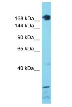 SETD1A / SET1 Antibody - SETD1A / SET1 antibody Western Blot of Breast Tumor. Antibody dilution: 1 ug/ml.  This image was taken for the unconjugated form of this product. Other forms have not been tested.