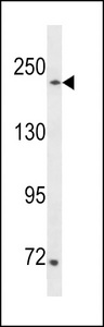 SETD1A / SET1 Antibody - SETD1A Antibody western blot of 293 cell line lysates (35 ug/lane). The SETD1A antibody detected the SETD1A protein (arrow).