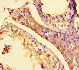 SETD1A / SET1 Antibody - Immunohistochemistry of paraffin-embedded human testis tissue at dilution of 1:100