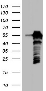 SETD2 Antibody - HEK293T cells were transfected with the pCMV6-ENTRY control (Left lane) or pCMV6-ENTRY SETD2 (Right lane) cDNA for 48 hrs and lysed. Equivalent amounts of cell lysates (5 ug per lane) were separated by SDS-PAGE and immunoblotted with anti-SETD2.