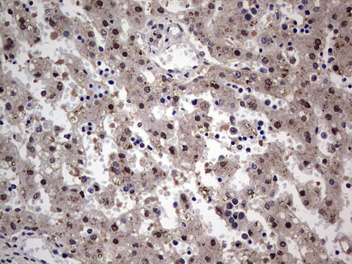 SETD2 Antibody - Immunohistochemical staining of paraffin-embedded Human embryonic liver tissue using anti-SETD2 mouse monoclonal antibody. (Heat-induced epitope retrieval by 1 mM EDTA in 10mM Tris, pH8.5, 120C for 3min,