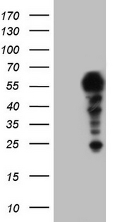 SETD2 Antibody - Human recombinant protein fragment corresponding to amino acids 1787-2144 of human SETD2 (NP_054878) produced in E.coli.