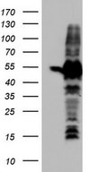 SETD2 Antibody - HEK293T cells were transfected with the pCMV6-ENTRY control (Left lane) or pCMV6-ENTRY SETD2 (Right lane) cDNA for 48 hrs and lysed. Equivalent amounts of cell lysates (5 ug per lane) were separated by SDS-PAGE and immunoblotted with anti-SETD2.