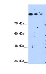 SETD2 Antibody - HepG2 cell lysate. at,. Antibody concentration: 1.25 ug/ml. Gel concentration: 8%.  This image was taken for the unconjugated form of this product. Other forms have not been tested.
