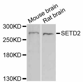 SETD2 Antibody - Western blot analysis of extracts of various cell lines, using SETD2 antibody at 1:1000 dilution. The secondary antibody used was an HRP Goat Anti-Rabbit IgG (H+L) at 1:10000 dilution. Lysates were loaded 25ug per lane and 3% nonfat dry milk in TBST was used for blocking. An ECL Kit was used for detection and the exposure time was 5s.