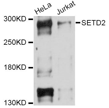 SETD2 Antibody - Western blot analysis of extracts of various cell lines, using SETD2 Antibody at 1:1000 dilution. The secondary antibody used was an HRP Goat Anti-Rabbit IgG (H+L) at 1:10000 dilution. Lysates were loaded 25ug per lane and 3% nonfat dry milk in TBST was used for blocking. An ECL Kit was used for detection and the exposure time was 15s.