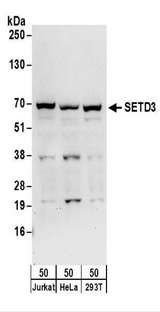 SETD3 Antibody - Detection of Human SETD3 by Western Blot. Samples: Whole cell lysate (50 ug) from Jurkat, HeLa, and 293T cells. Antibodies: Affinity purified rabbit anti-SETD3 antibody used for WB at 0.1 ug/ml. Detection: Chemiluminescence with an exposure time of 30 seconds.