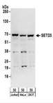 SETD3 Antibody - Detection of Human SETD3 by Western Blot. Samples: Whole cell lysate (50 ug) from Jurkat, HeLa, and 293T cells. Antibodies: Affinity purified rabbit anti-SETD3 antibody used for WB at 0.1 ug/ml. Detection: Chemiluminescence with an exposure time of 30 seconds.