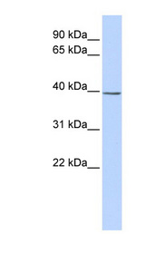 SETD3 Antibody - SETD3 antibody Western blot of Jurkat lysate. This image was taken for the unconjugated form of this product. Other forms have not been tested.