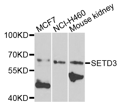 SETD3 Antibody - Western blot analysis of extracts of various cells.