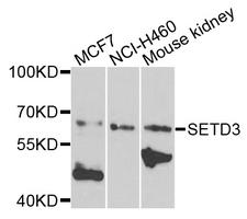 SETD3 Antibody - Western blot analysis of extracts of various cells.