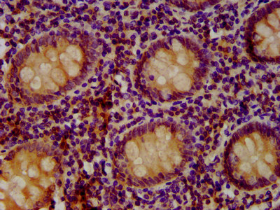 SETD3 Antibody - Immunohistochemistry image at a dilution of 1:400 and staining in paraffin-embedded human appendix tissue performed on a Leica BondTM system. After dewaxing and hydration, antigen retrieval was mediated by high pressure in a citrate buffer (pH 6.0) . Section was blocked with 10% normal goat serum 30min at RT. Then primary antibody (1% BSA) was incubated at 4 °C overnight. The primary is detected by a biotinylated secondary antibody and visualized using an HRP conjugated SP system.