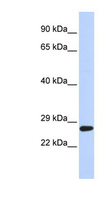 SETD4 Antibody - SETD4 antibody Western blot of 721_B cell lysate. This image was taken for the unconjugated form of this product. Other forms have not been tested.
