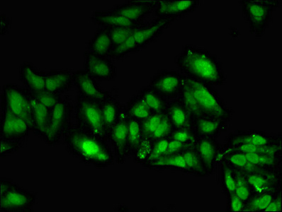 SETD5 Antibody - Immunofluorescent analysis of Hela cells using SETD5 Antibody at dilution of 1:100 and Alexa Fluor 488-congugated AffiniPure Goat Anti-Rabbit IgG(H+L)