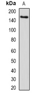 SETD5 Antibody - Western blot analysis of SETD5 expression in human liver (A) whole cell lysates.