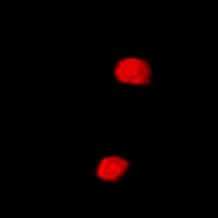 SETD5 Antibody - Immunofluorescent analysis of SETD5 staining in MCF7 cells. Formalin-fixed cells were permeabilized with 0.1% Triton X-100 in TBS for 5-10 minutes and blocked with 3% BSA-PBS for 30 minutes at room temperature. Cells were probed with the primary antibody in 3% BSA-PBS and incubated overnight at 4 deg C in a humidified chamber. Cells were washed with PBST and incubated with a DyLight 594-conjugated secondary antibody (red) in PBS at room temperature in the dark.