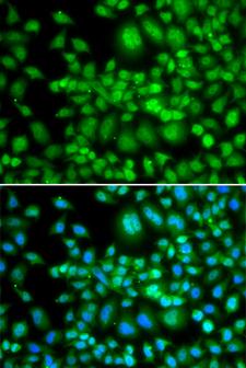 SETD5 Antibody - Immunofluorescence analysis of MCF-7 cells using SETD5 Polyclonal Antibody.