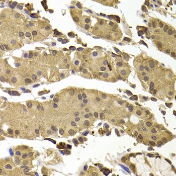 SETD5 Antibody - Immunohistochemistry of paraffin-embedded Human stomach using SETD5 Polyclonal Antibody at dilution of 1:100 (40x lens).