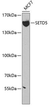 SETD5 Antibody - Western blot analysis of extracts of MCF-7 cells using SETD5 Polyclonal Antibody at dilution of 1:300.