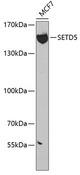 SETD5 Antibody - Western blot analysis of extracts of MCF-7 cells using SETD5 Polyclonal Antibody at dilution of 1:300.