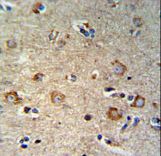SETD6 Antibody - SETD6 Antibody IHC of formalin-fixed and paraffin-embedded brain tissue followed by peroxidase-conjugated secondary antibody and DAB staining.