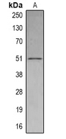 SETD6 Antibody - Western blot analysis of SETD6 expression in THP1 (A) whole cell lysates.