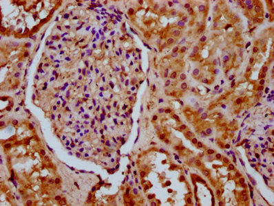 SETD6 Antibody - Immunohistochemistry Dilution at 1:200 and staining in paraffin-embedded human kidney tissue performed on a Leica BondTM system. After dewaxing and hydration, antigen retrieval was mediated by high pressure in a citrate buffer (pH 6.0). Section was blocked with 10% normal Goat serum 30min at RT. Then primary antibody (1% BSA) was incubated at 4°C overnight. The primary is detected by a biotinylated Secondary antibody and visualized using an HRP conjugated SP system.