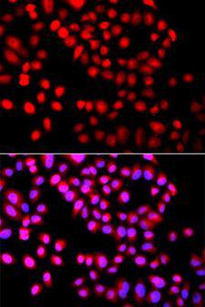 SETD6 Antibody - Immunofluorescence analysis of A549 cells using SETD6 antibody. Blue: DAPI for nuclear staining.