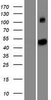 SETD6 Protein - Western validation with an anti-DDK antibody * L: Control HEK293 lysate R: Over-expression lysate