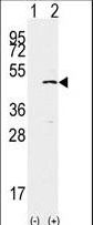 SETD7 / SET7 Antibody - Western blot of SET9(arrow) using rabbit polyclonal SET9 Antibody. 293 cell lysates (2 ug/lane) either nontransfected (Lane 1) or transiently transfected with the SET9 gene (Lane 2) (Origene Technologies).