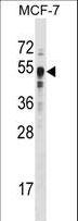 SETD7 / SET7 Antibody - SET9 Antibody (S174) western blot of MCF-7 cell line lysates (35 ug/lane). The SET9 antibody detected the SET9 protein (arrow).