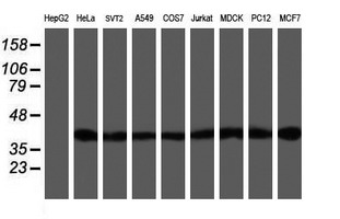 SETD7 / SET7 Antibody - Western blot of extracts (35ug) from 9 different cell lines by using anti-SETD7 monoclonal antibody.