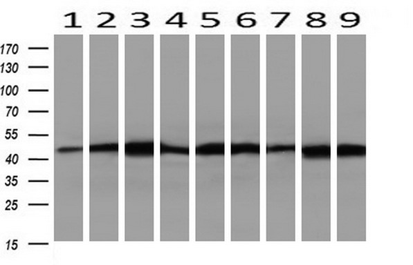 SETD7 / SET7 Antibody - Western blot of extracts (10ug) from 9 Human tissue by using anti-SETD7 monoclonal antibody at 1:200 (1: Testis; 2: Omentum; 3: Uterus; 4: Breast; 5: Brain; 6: Liver; 7: Ovary; 8: Thyroid gland; 9: colon).