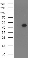 SETD7 / SET7 Antibody - HEK293T cells were transfected with the pCMV6-ENTRY control (Left lane) or pCMV6-ENTRY SETD7 (Right lane) cDNA for 48 hrs and lysed. Equivalent amounts of cell lysates (5 ug per lane) were separated by SDS-PAGE and immunoblotted with anti-SETD7.